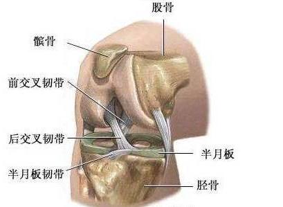 膝关节骨刺