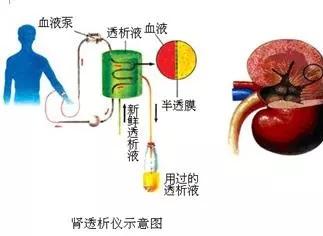 腎透析