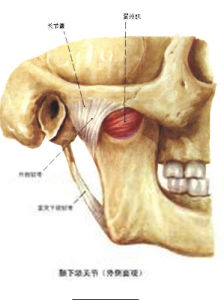 颞下颌关节炎