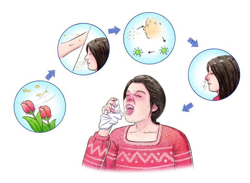 尘螨过敏性鼻炎