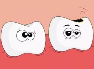 牙齒腐蝕