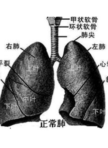 脱屑性间质性肺炎