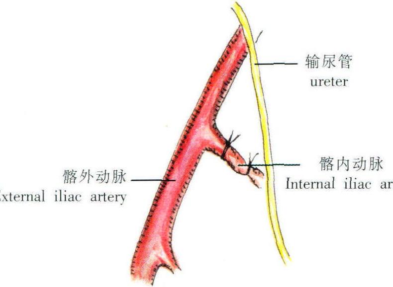 髂外動脈