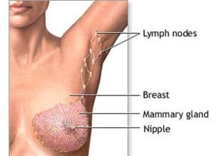 乳腺癌化療
