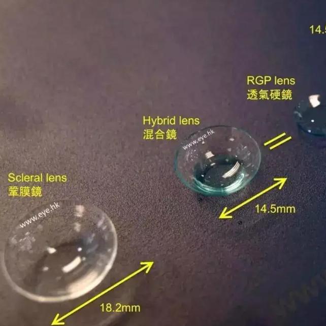 硬性透氧性角膜接触镜