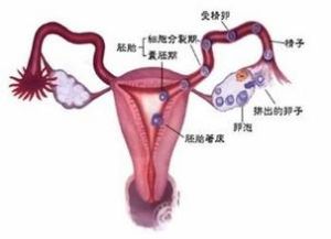 子宫输卵管造影