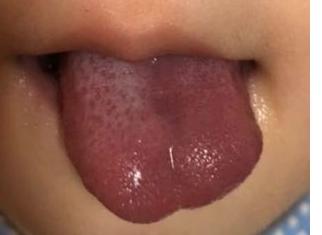 青紫舌